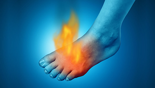 illustration foot with flames