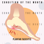Plantar Fasciitis