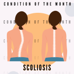scoliosis