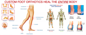 foot_orthotics