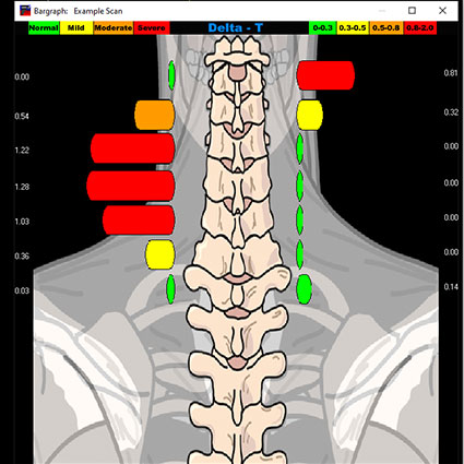 thermography neck scan graphic