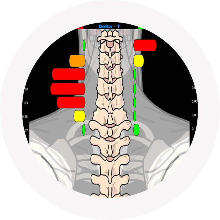 Spine graphic