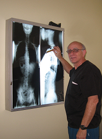 West Los Angeles chiropractor Dr. Jeffrey Jacobs
