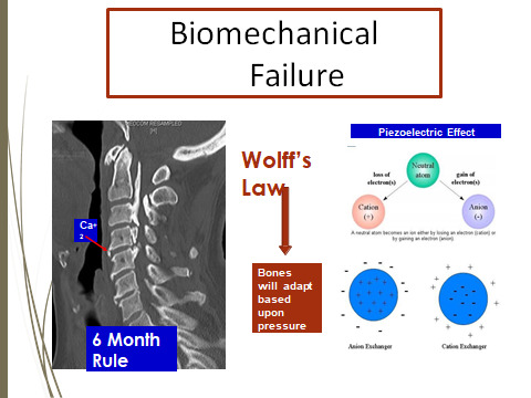 biomechanical-failure