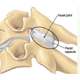 Facet Joint