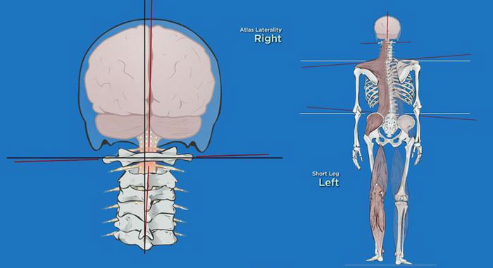 ligament-alignment