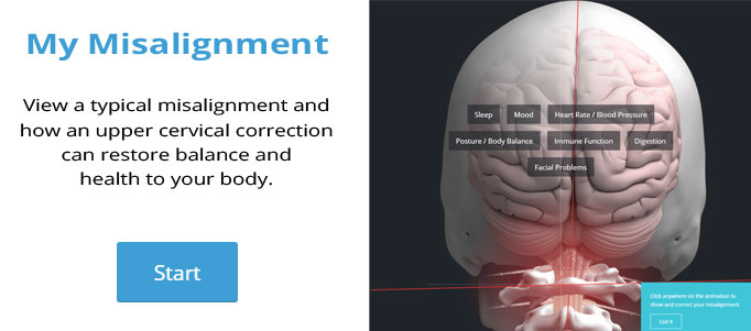 Misalignment survey