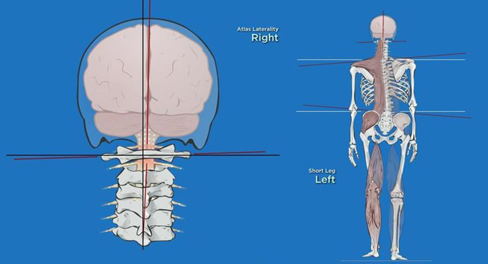 spine pelvic tilt