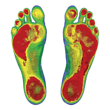 Foot Levelers scan of feet