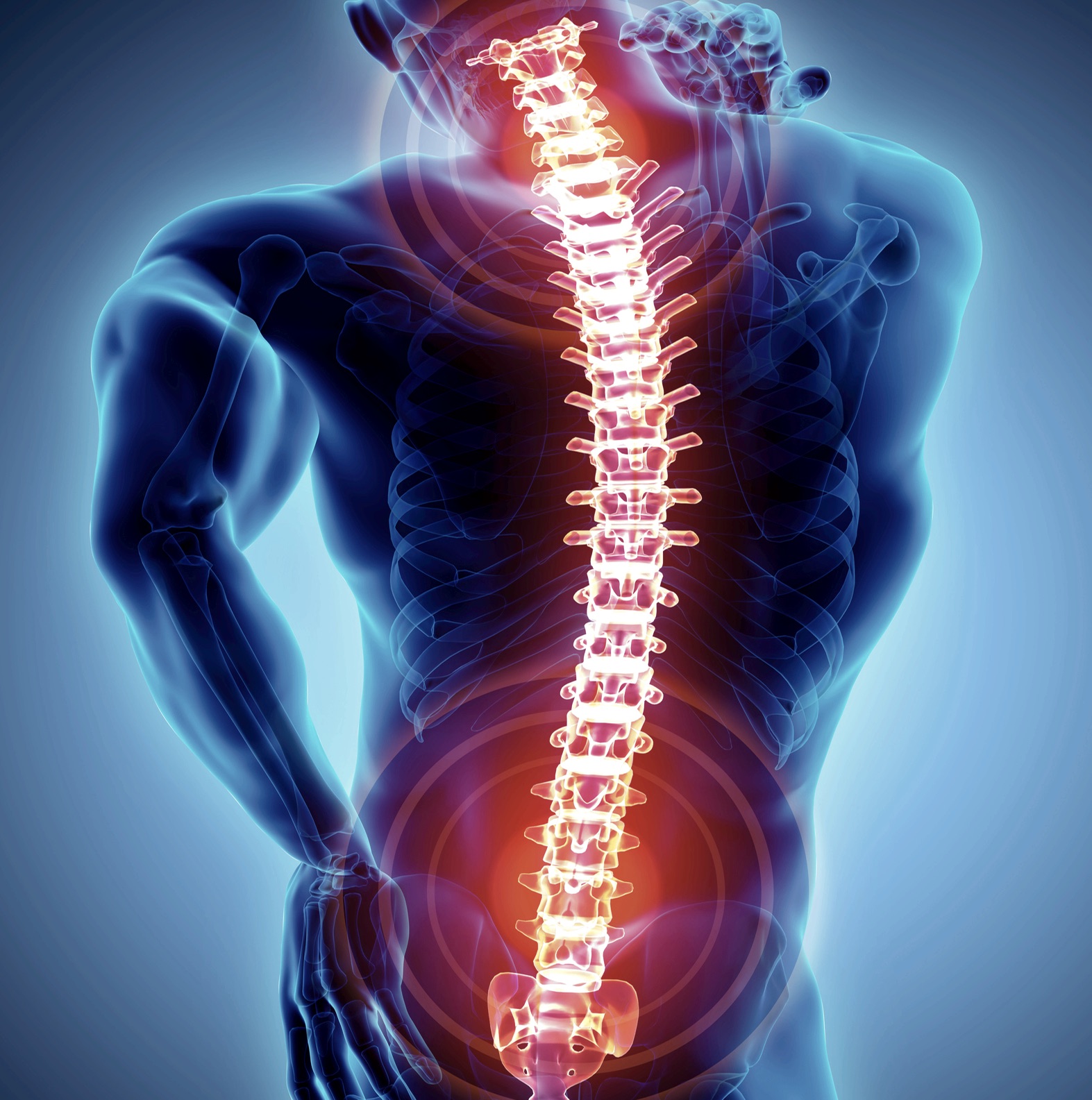 3D Illustration of lumbar and cervical pain.