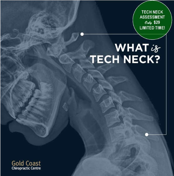 tech neck illustration