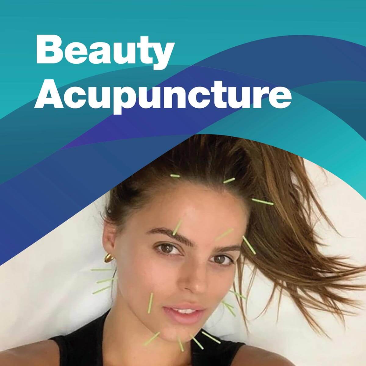 Facial Rejuvenation Acupuncture, a.k.a. Beauty Acupuncture