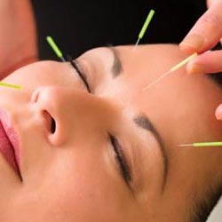 Facial acupuncture