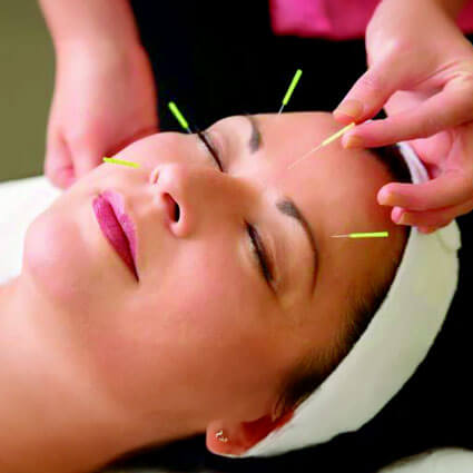 Facial Acupuncture