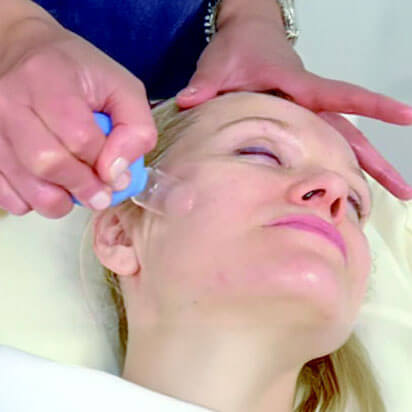 Facial Cupping