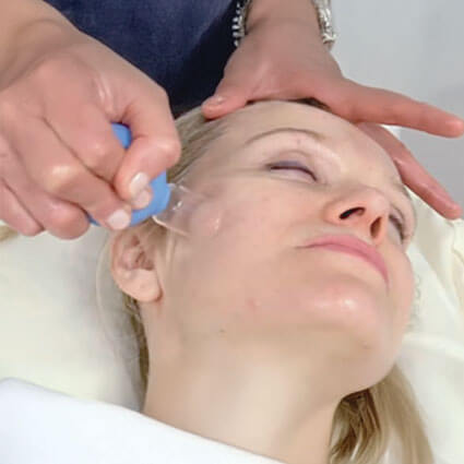 Facial Cupping