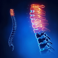 blue spine images