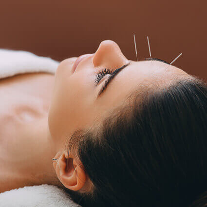 woman-relaxing-with-acupuncture-needles-in-forehead-sq
