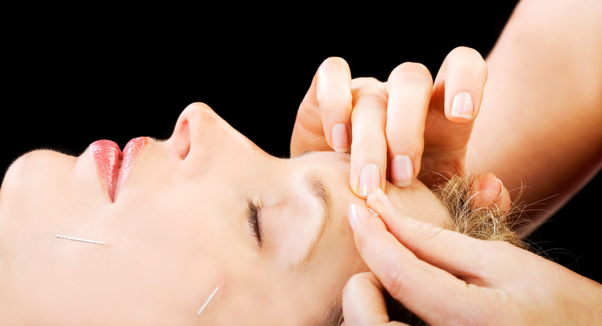 Dry Needling Therapy used on face