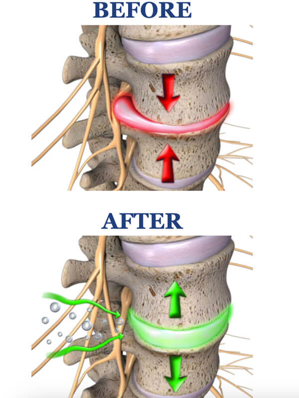 before-and-after-spine-illustration