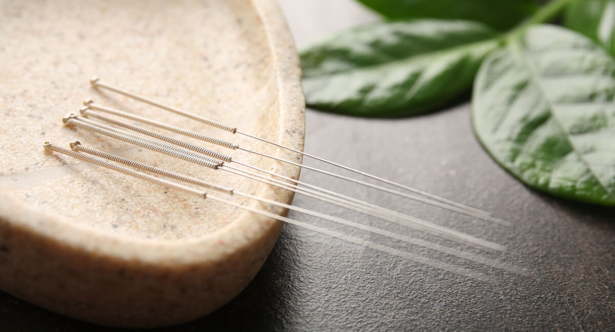 Acupuncture needles
