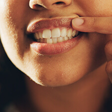 woman looking at her gums in a mirror