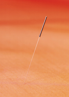 Acupuncture Needle