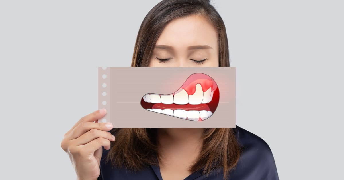 Woman with inflamed gums.