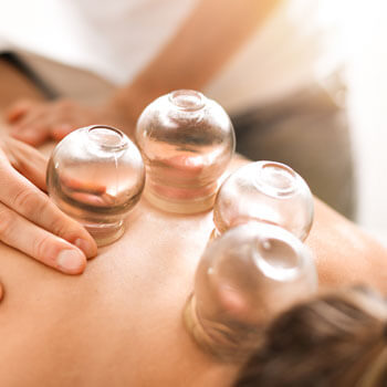 cupping therapy on upper back