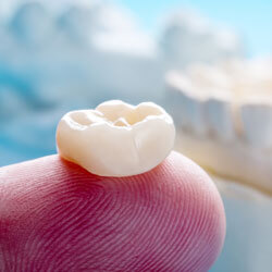 dental crown resting on fingertip