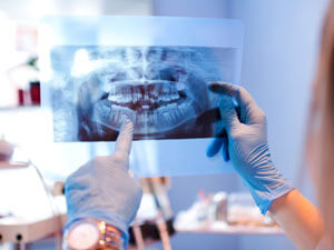 Dental xrays