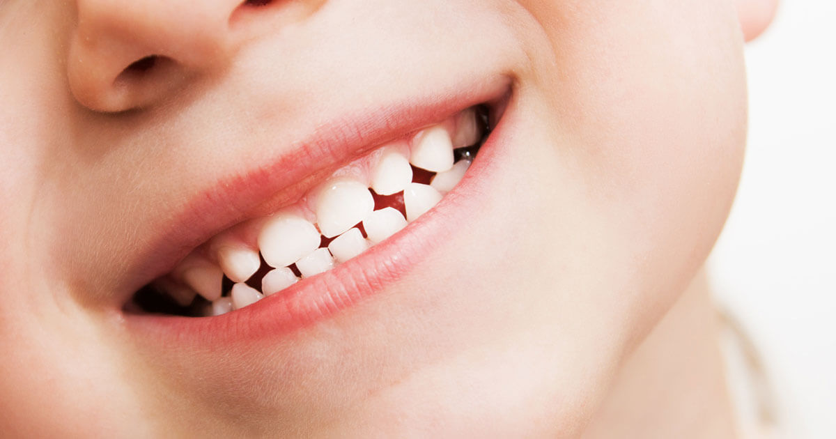 closeup baby teeth smile