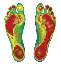 foot scan