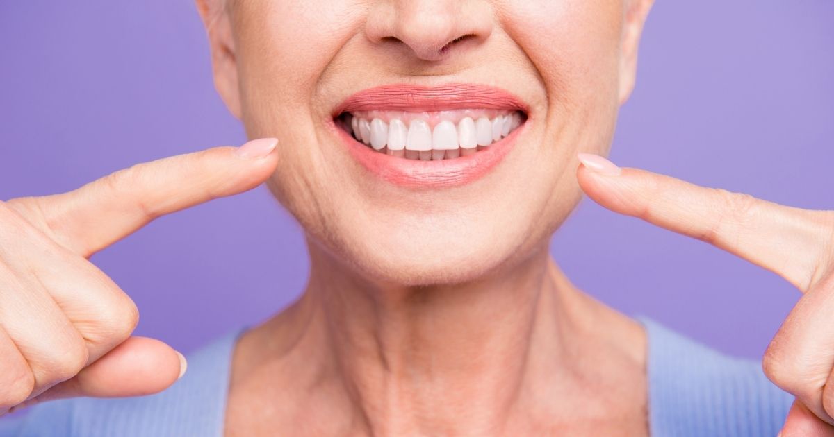 Woman pointing to her gummy smile.