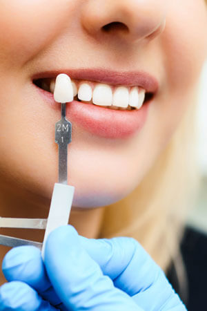 teeth whitening process