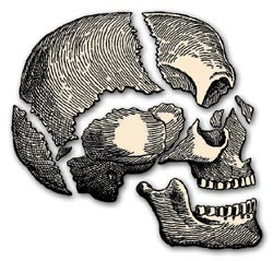 Bones of the skull