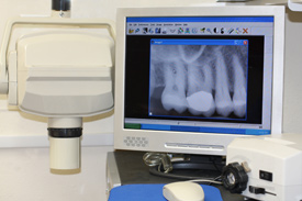 Digital radiography equipment