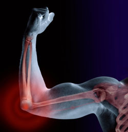 Man with elbow pain flexing bicep