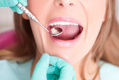 dentist examining a tooth