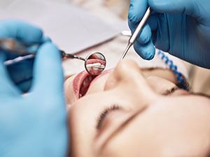 woman during a dental oral exam