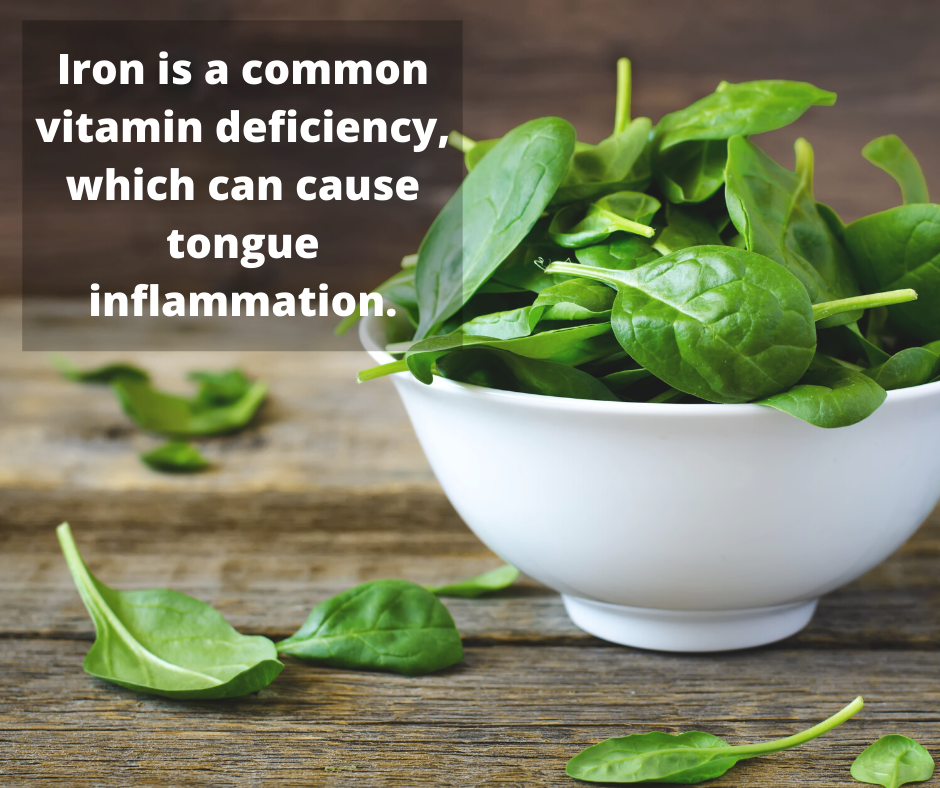 Iron is a common vitamin deficiency which can cause tongue inflammation.