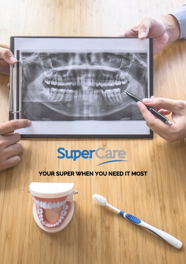 marketing collateral image with SuperCare Logo, toothbroth and model of teeth