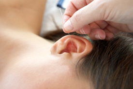 Lady getting acupuncture in ear