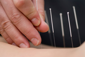 Woodward Acupuncture