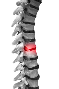 Spine image with pain indicator