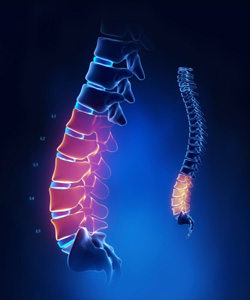 Fibromylgia and Chiropractic care