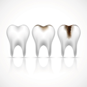 Root Canal Treatment Templestowe Lower