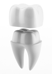 dental crowns Perth