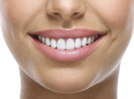 Veneers Wangaratta