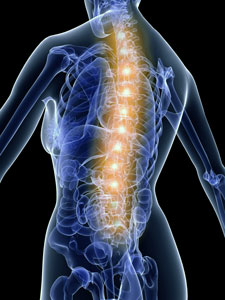 X-Ray of spine